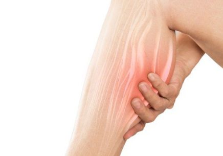 Dry-needling 4